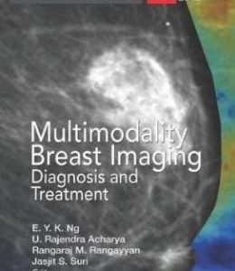 Multimodality Breast Imaging: Diagnosis and Treatment