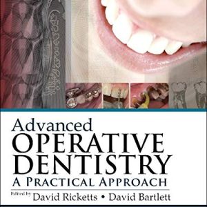Advanced Operative Dentistry: A Practical Approach (Original PDF from Publisher)