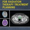 Strategies for Radiation Therapy Treatment Planning (Original PDF from Publisher)