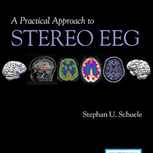 A Practical Approach to Stereo EEG (Original PDF from Publisher)