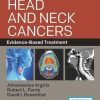 Head and Neck Cancers: Evidence-Based Treatment (PDF)