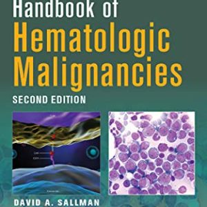 Handbook of Hematologic Malignancies, Second Edition (Original PDF from Publisher)