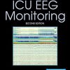 Handbook of ICU EEG Monitoring, 2nd Edition (PDF)