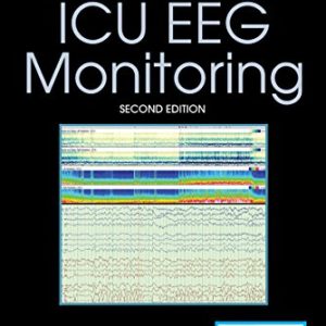 Handbook of ICU EEG Monitoring, 2nd Edition (PDF)