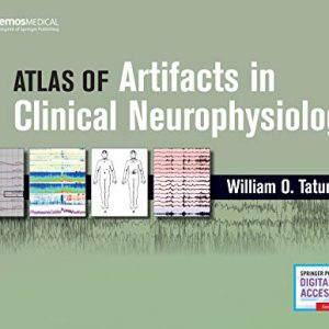 Atlas of Artifacts in Clinical Neurophysiology (Original PDF from Publisher)