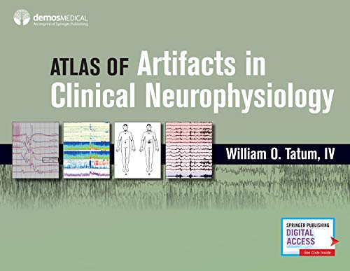Atlas of Artifacts in Clinical Neurophysiology (Original PDF from Publisher)