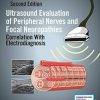 Ultrasound Evaluation of Peripheral Nerves and Focal Neuropathies, 2ed: Correlation With Electrodiagnosis (Original PDF from Publisher)