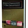 Surgical Complications in Oral Implantology: Etiology, Prevention, and Management (AZW3 + EPUB + Converted PDF)