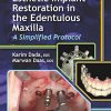 Esthetic Implant Restoration in the Edentulous Maxilla: A Simplified Protocol