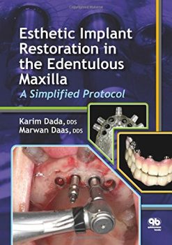 Esthetic Implant Restoration in the Edentulous Maxilla: A Simplified Protocol
