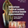 Noncarious Cervical Lesions and Cervical Dentin Hypersensitivity: Etiology, Diagnosis, and Treatment (Original PDF from Publisher)