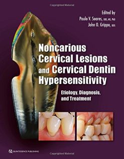 Noncarious Cervical Lesions and Cervical Dentin Hypersensitivity: Etiology, Diagnosis, and Treatment (Original PDF from Publisher)