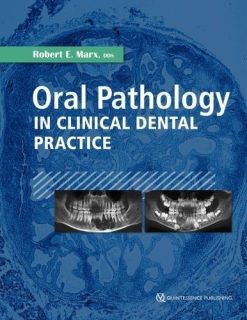 Oral Pathology in Clinical Dental Practice (Original PDF from Publisher)