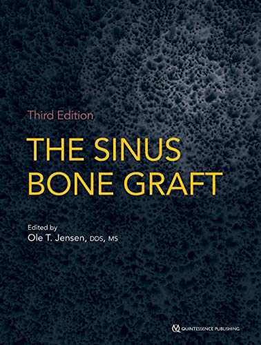 The Sinus Bone Graft, 3rd Edition