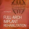 Full-Arch Implant Rehabilitation
