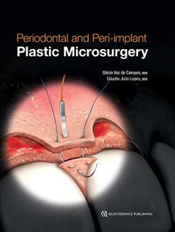 Periodontal and Peri-implant Plastic Microsurgery: Minimally Invasive Techniques with Maximum Precision (Original PDF from Publisher)