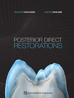 Posterior Direct Restorations (Original PDF from Publisher)