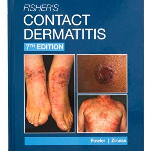 Fisher’s Contact Dermatitis, 7th Edition (ePub+Converted PDF)