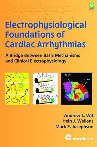 Electrophysiological Foundations of Cardiac Arrhythmias: A Bridge Between Basic Mechanisms and Clinical Electrophysiology (EPUB)