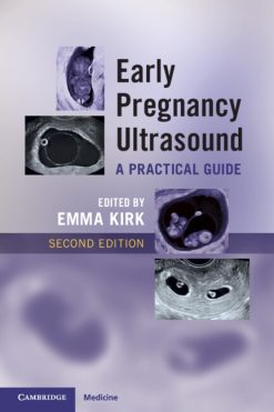 Early Pregnancy Ultrasound: A Practical Guide, 2nd edition (Original PDF from Publisher)