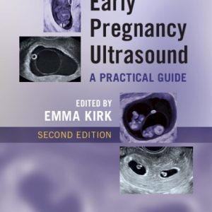 Early Pregnancy Ultrasound: A Practical Guide, 2nd edition (Original PDF from Publisher)