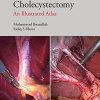 Safe Laparoscopic Cholecystectomy: An Illustrated Atlas (Original PDF from Publisher)