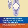 The Human Brain during the First Trimester 6.3- to 10.5-mm Crown-Rump Lengths: Atlas of Human Central Nervous System Development, Volume 2 (Atlas of Human Central Nervous System Development, 2) (Original PDF from Publisher)