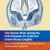 The Human Brain during the First Trimester 57- to 60-mm Crown-Rump Lengths: Atlas of Human Central Nervous System Development, Volume 7 (EPUB)
