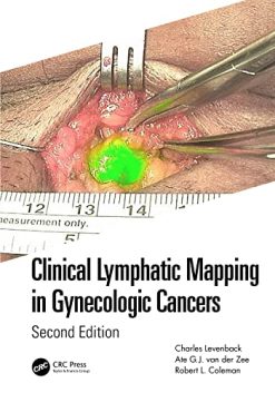 Clinical Lymphatic Mapping in Gynecologic Cancers, 2nd Edition (Original PDF from Publisher)