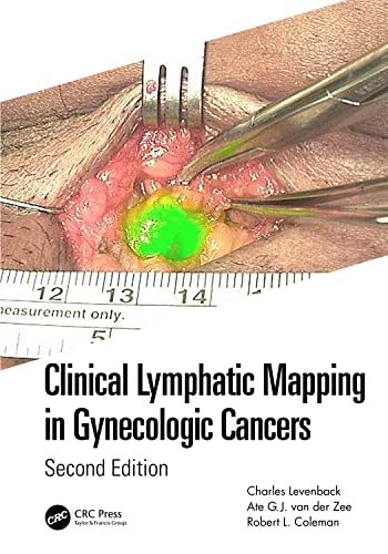 Clinical Lymphatic Mapping in Gynecologic Cancers, 2nd Edition (Original PDF from Publisher)