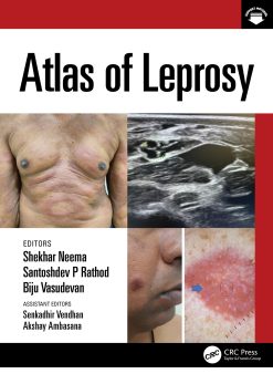 Atlas of Leprosy (EPUB)