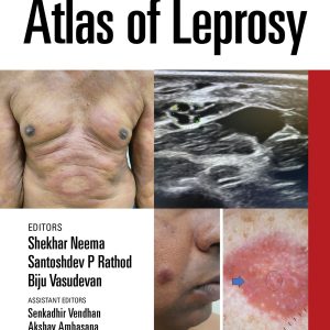 Atlas of Leprosy (EPUB)