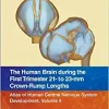 The Human Brain during the First Trimester 21- to 23-mm Crown-Rump Lengths: Atlas of Human Central Nervous System Development, Volume 4 (Original PDF from Publisher)