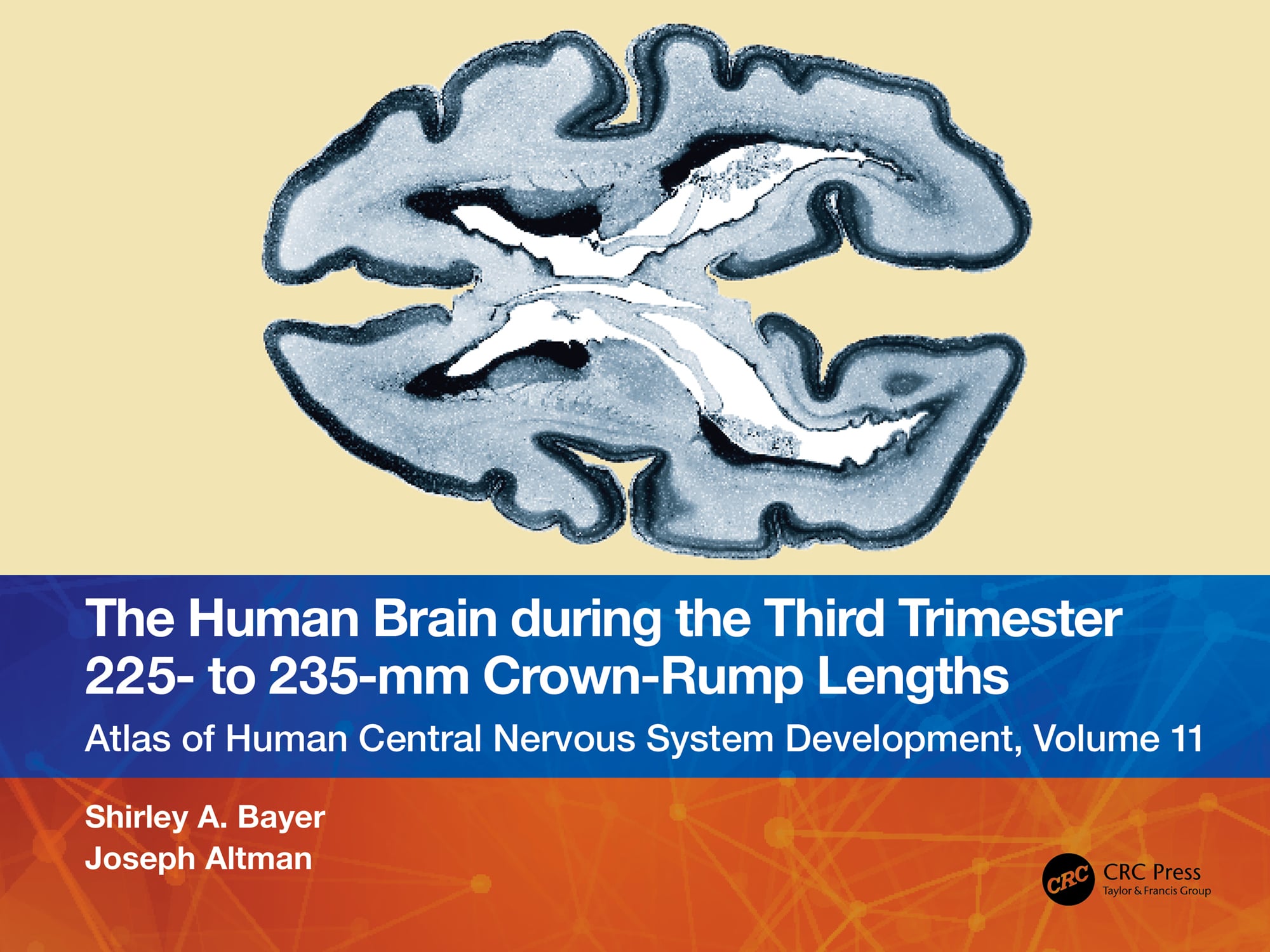 The Human Brain during the Third Trimester 225– to 235–mm Crown-Rump Lengths: Atlas of Central Nervous System Development, Volume 11 (EPUB)