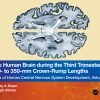 The Human Brain during the Third Trimester 310– to 350–mm Crown-Rump Lengths: Atlas of Central Nervous System Development, Volume 13 (EPUB)