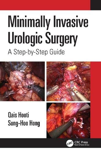 Minimally Invasive Urologic Surgery: A Step-by-Step Guide (Original PDF from Publisher)