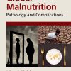 Global Malnutrition: Pathology and Complications (Original PDF from Publisher)