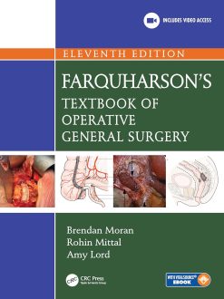 Farquharson’s Textbook of Operative General Surgery, 11th Edition (EPUB)