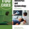 100 Cases in Obstetrics and Gynaecology, 3rd Edition (EPUB)