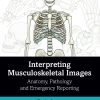 Interpreting Musculoskeletal Images (EPUB)