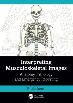 Interpreting Musculoskeletal Images (EPUB)