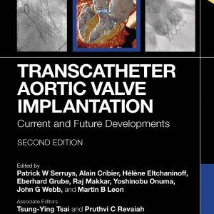 Transcatheter Aortic Valve Implantation: Current and Future Developments, 2nd Edition (EPUB)