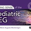 Making Sense of the Pediatric EEG (EPUB)
