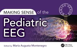 Making Sense of the Pediatric EEG (EPUB)