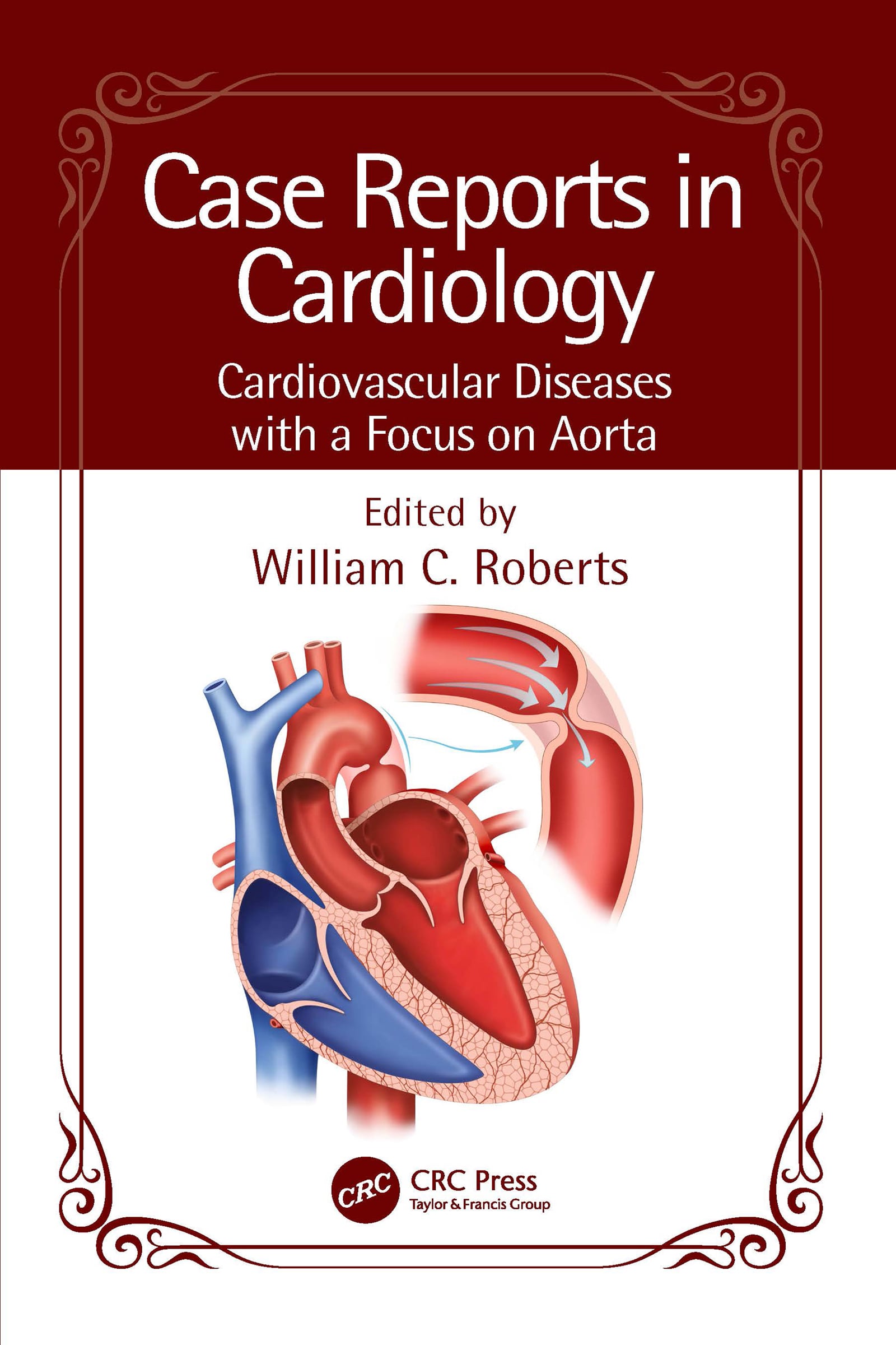 Case Reports in Cardiology: Cardiovascular Diseases with a Focus on Aorta (EPUB)
