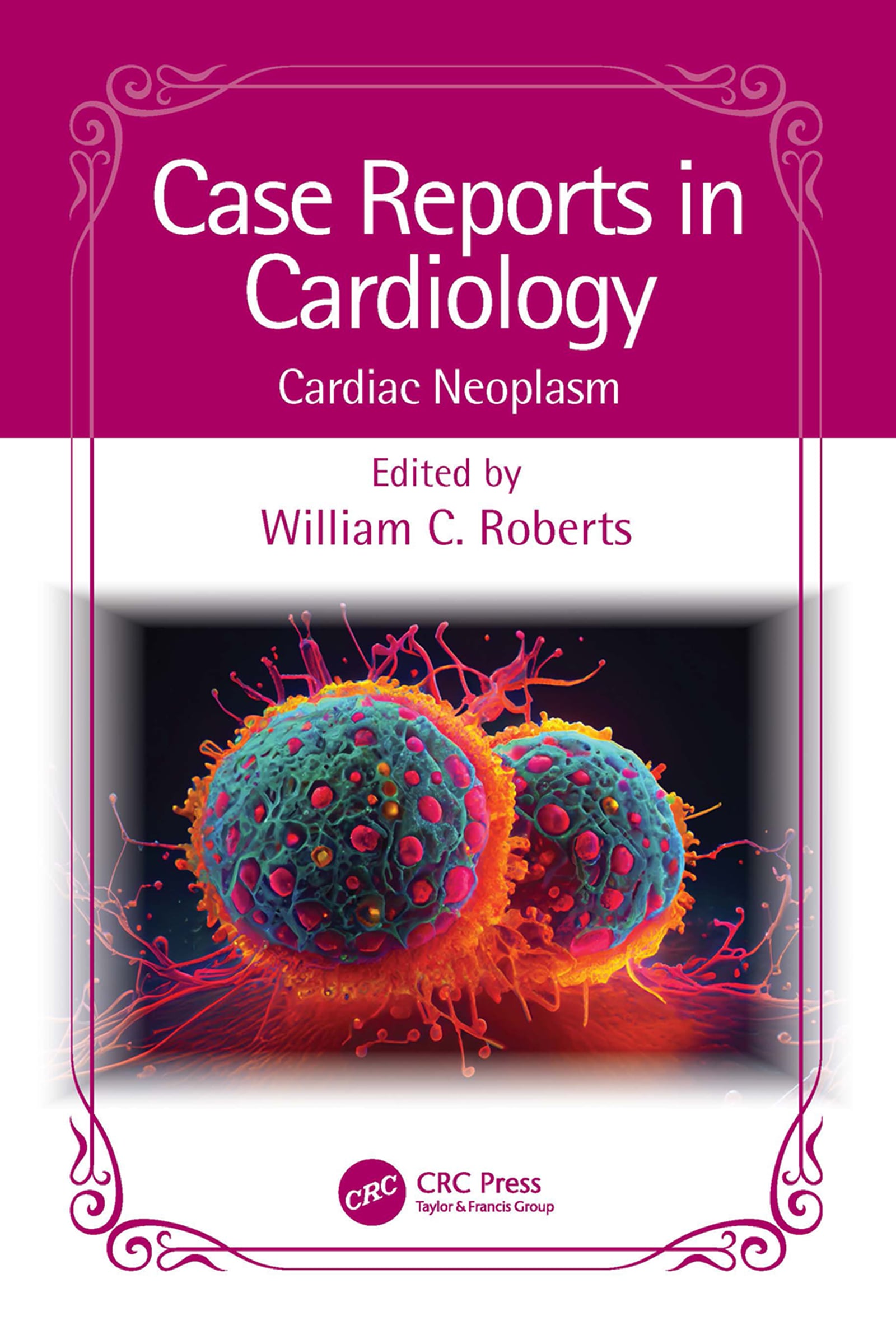 Case Reports in Cardiology: Cardiac Neoplasm (EPUB)