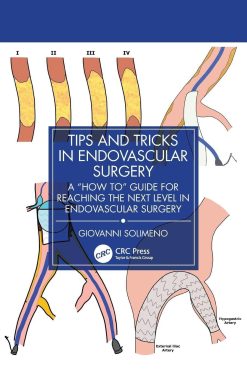 Tips and Tricks in Endovascular Surgery: A “How to” Guide for reaching the next Level in Endovascular Surgery (EPUB)