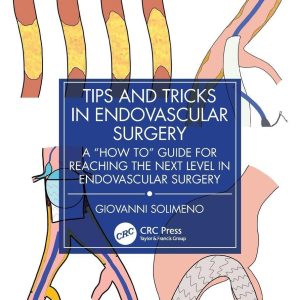 Tips and Tricks in Endovascular Surgery: A “How to” Guide for reaching the next Level in Endovascular Surgery (EPUB)
