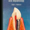 Surgical and Prosthetic Oral Implantology (Original PDF from Publisher)