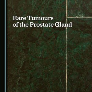 Rare Tumours of the Prostate Gland (Original PDF from Publisher)